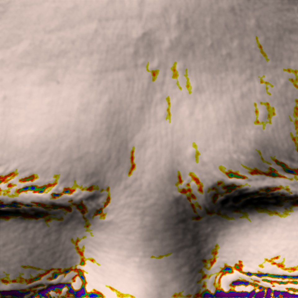 Rejuvenating Line wrinkle after