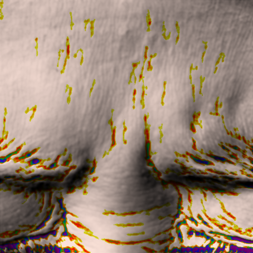 Rejuvenating Line wrinkle before